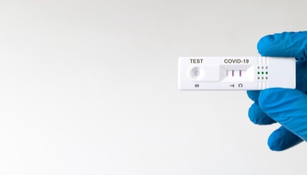 Rapid COVID-19 Antigen Tests