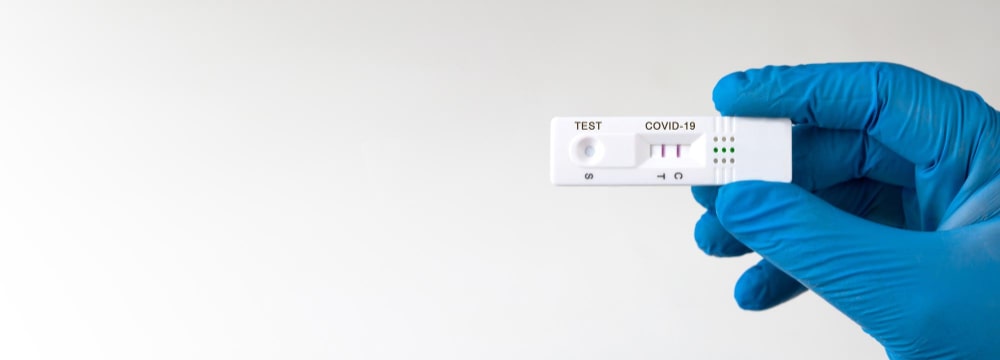 Rapid COVID-19 Antigen Tests